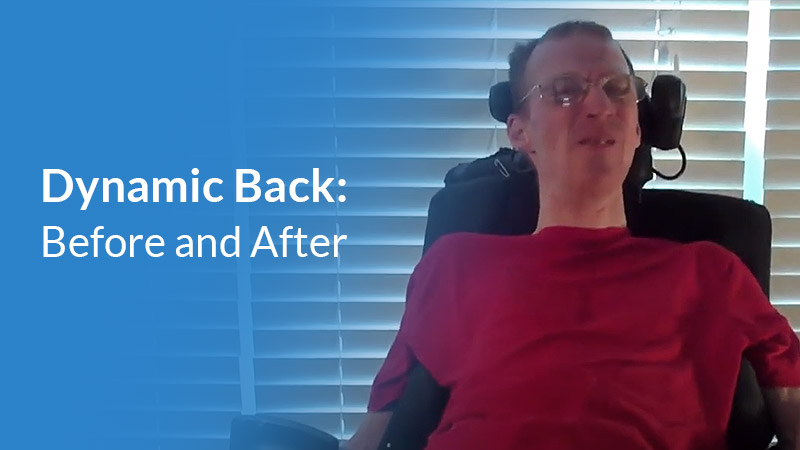 Carl before and after dynamic rocker back