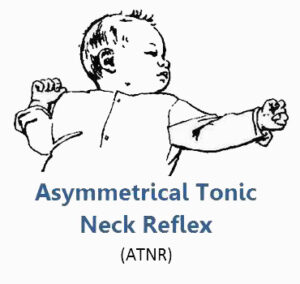 seating dynamics asymmetrical tonic neck reflex