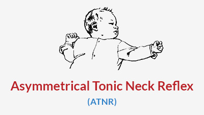 seating dynamics blog asymmetrical tonic neck reflex