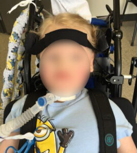 seating dynamics positioning the head